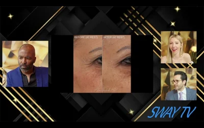 Dr. Foulad Discusses Achieving Natural Results with Botox