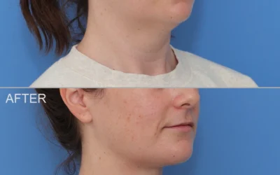 Case 1159