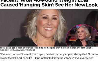 Ricki Lake Had a ‘Neck and Lower Facelift’ After 40-Pound Weight Loss Caused ‘Hanging Skin’