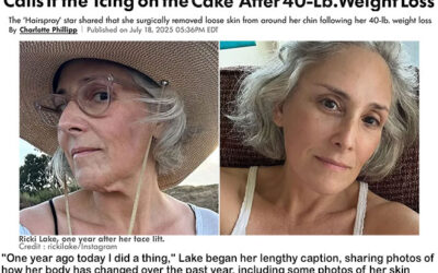 Ricki Lake Celebrates 1 Year Since Her Facelift and Calls It the ‘Icing on the Cake’ after 40-Lb. Weight Loss